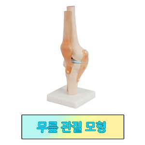 무릎 관절 모형